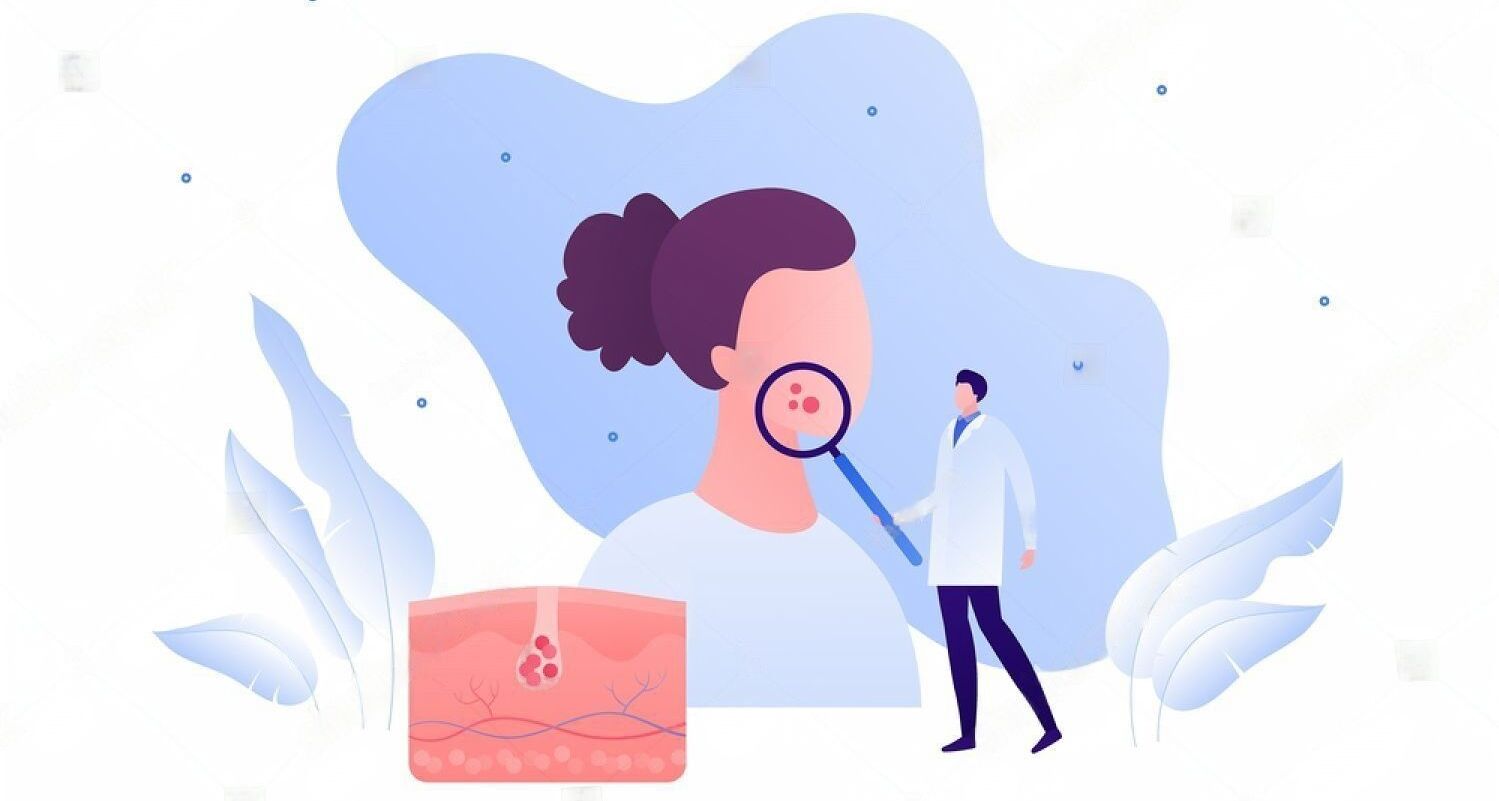 Skin Disorders